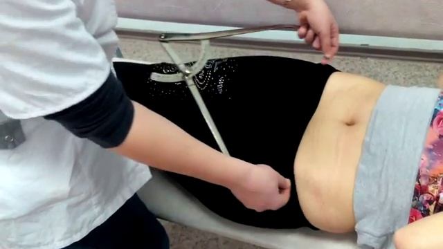 Измерение наружных размеров таза