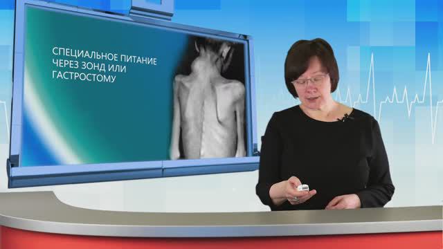 СПЕЦИАЛЬНОЕ ПИТАНИЕ ЧЕРЕЗ ЗОНД ИЛИ ГАСТРОСТОМУ