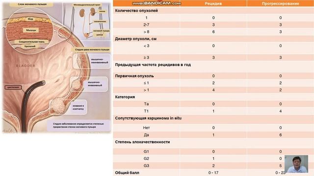 Яковлев Владислав Дмитриевич. Рак мочевого пузыря. Лекторий "Про_Жизнь". Виталогия. Май-июнь 2020. смотреть онлайн