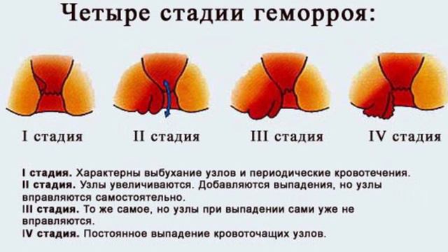 Гепатромбин Г: показания и инструкция по применению, цена, аналоги, отзывы