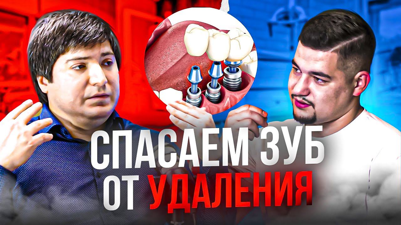 Реставрация. Всё о коронках. (ЗУБ ДАЮ! Подкаст)