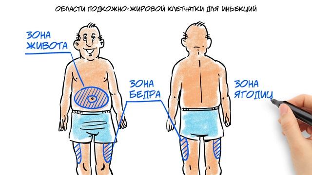 Техника инъекций. Как правильно делать инъекцию инсулина?