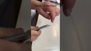 Тигерштедта