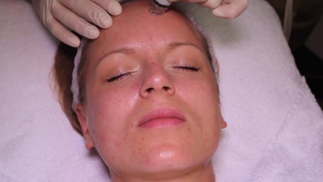 Hydra Facial