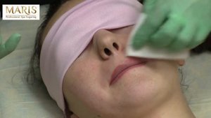 Марис. Шугаринг лица. Часть 2 (усики)