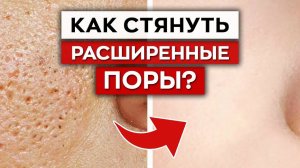 Как бороться с расширенными порами? / Как ухаживать за жирной кожей лица?