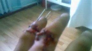 рассомаха жесть