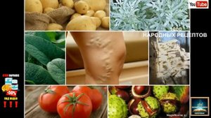 Зеленые Помидоры От Варикоза Правда. Лечение Варикоза Зелеными Помидорами Видео