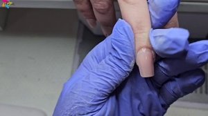 Коррекция ногтей на верхних формах/Французский маникюр