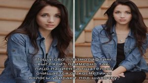 Regenlab – плазмолифтинг нового поколения