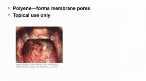 USMLE RX - 7.Микробиология - 1.Антимикробные средства - 39.Нистатин