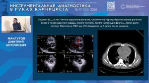 Эхокардиография у раненых с современной боевой травмой