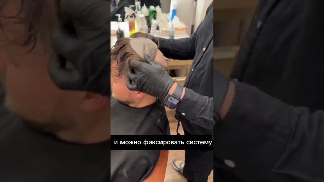 Система волос для мужчин