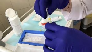 Белларти в клинике Эталон. Часть 2