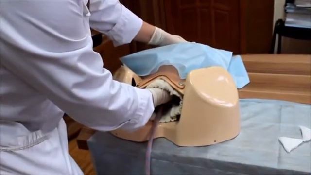 Ручное отделение плаценты
