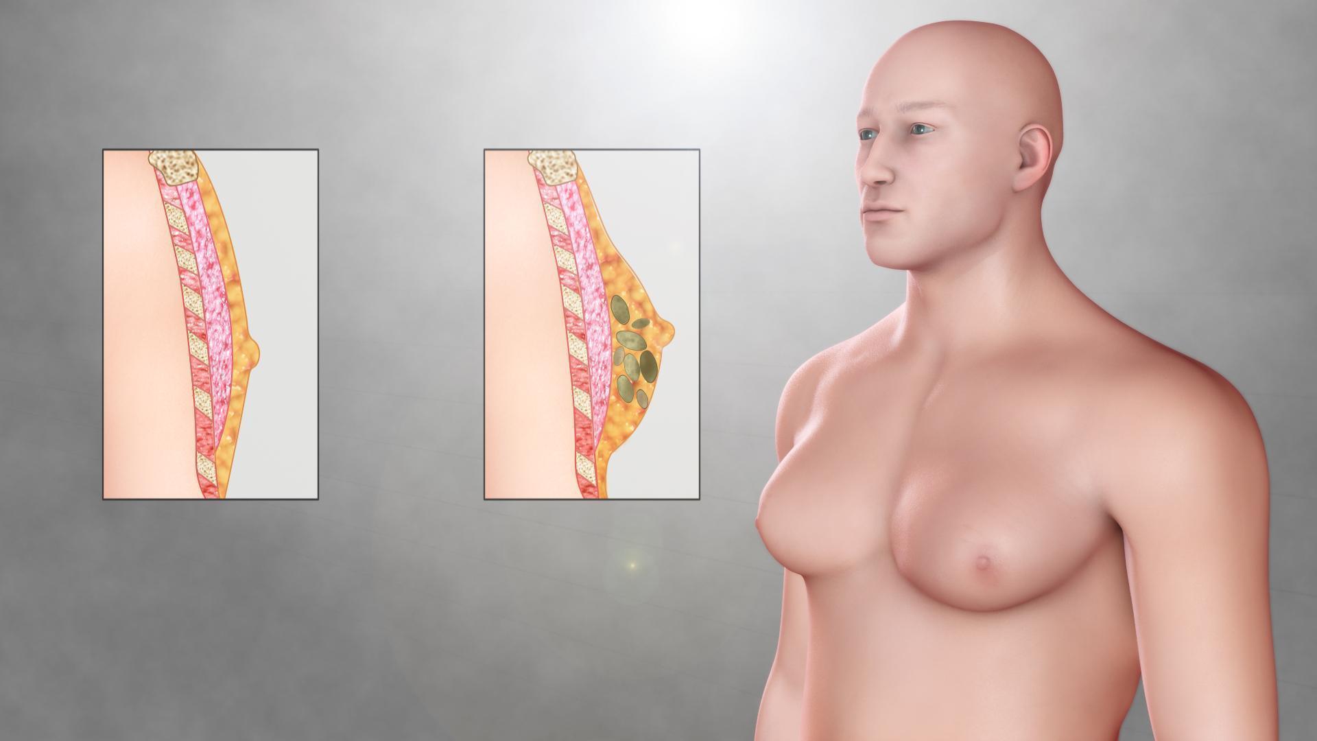 почему у женщин увеличивается грудь (120) фото
