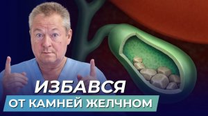 КАМНИ В ЖЕЛЧНОМ ПУЗЫРЕ - профилактика и лечение без оперативного вмешательства