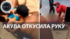 Акула откусила руку девушке в Бразилии | Видео