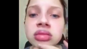 Я губы себе увеличила!