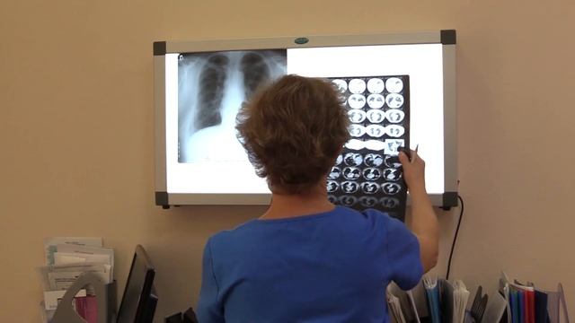 Вреден ли смог? Главный пульмонолог Кузбасса о болезнях органов дыхания. смотреть онлайн