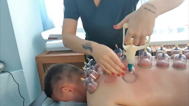 ?ВАКУУМНЫЕ БАНКИ! ВАКУУМНЫЙ МАССАЖ!? смотреть онлайн