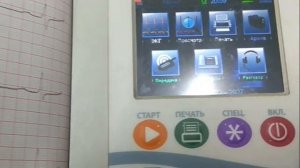 Передача ЭКГ в режиме GSM на аппарате "ВАЛЕНТА"