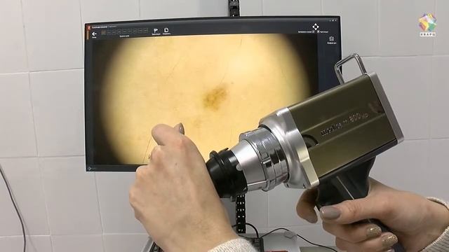 В Подольском кожно-венерологическом диспансере установили новое оборудование смотреть онлайн