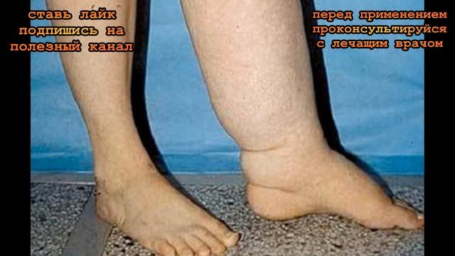 ★8 проблем ног, которые могут говорить о серьезных заболеваниях. смотреть онлайн