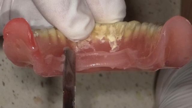 Реконструкция базиса протеза по японской методике смотреть онлайн