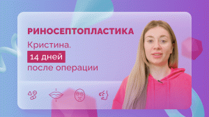 Кристина снятие последнего гипса11.05.2022