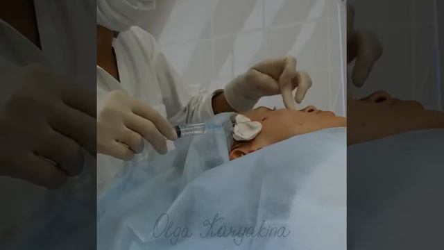 Анестезия. Подготовка к нитевой подтяжке лица Aptos Exellence Visage