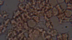 Seilwurm Labor Berlin. Wir machen Blut und Schpeichel Mikroskopie Kostenlos! www.seilwurm.de