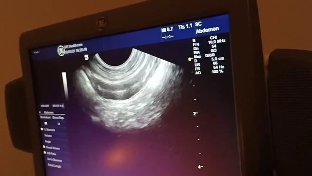 Мастер класс по УЗИ Ветеринария #ветеринар #узи #медицина #хирург #доктор #собака #кіт смотреть онлайн