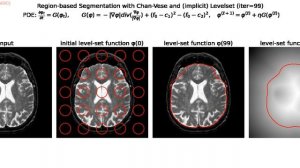 Region-based Segmentation | Chan-Vese | Snakes | Level Sets | Gradient Descent | python