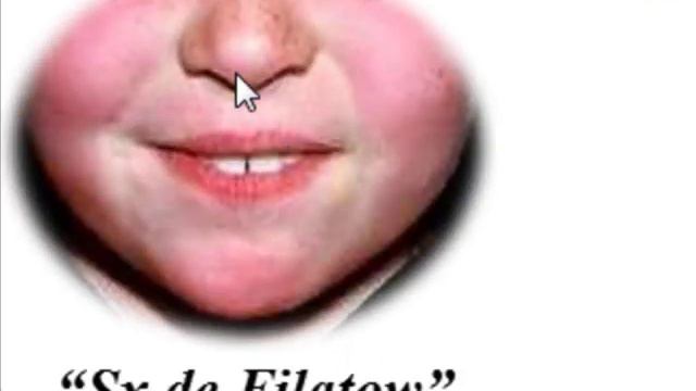 Streptococcus Pyogenes смотреть онлайн