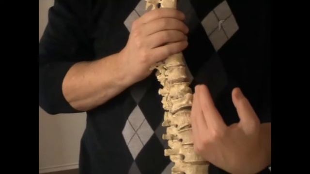 Грыжи дисков L1-L2, L2-L3, L3-L4. Причины. Часть 2. смотреть онлайн