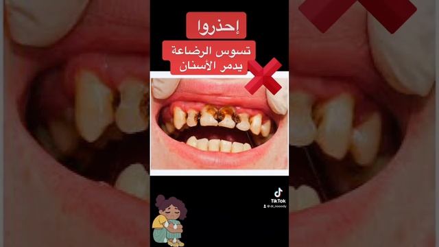 إحذروا تسوس الرضاعة يدمر أسنان أطفالكم ? смотреть онлайн