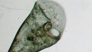 Инфузория трубач