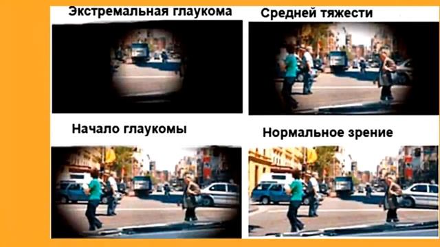 ЛЕЧЕНИЕ ГЛАЗ ПРИ ГЛАУКОМЕ. ПРОФЕССОР М.КРАСНОВ смотреть онлайн