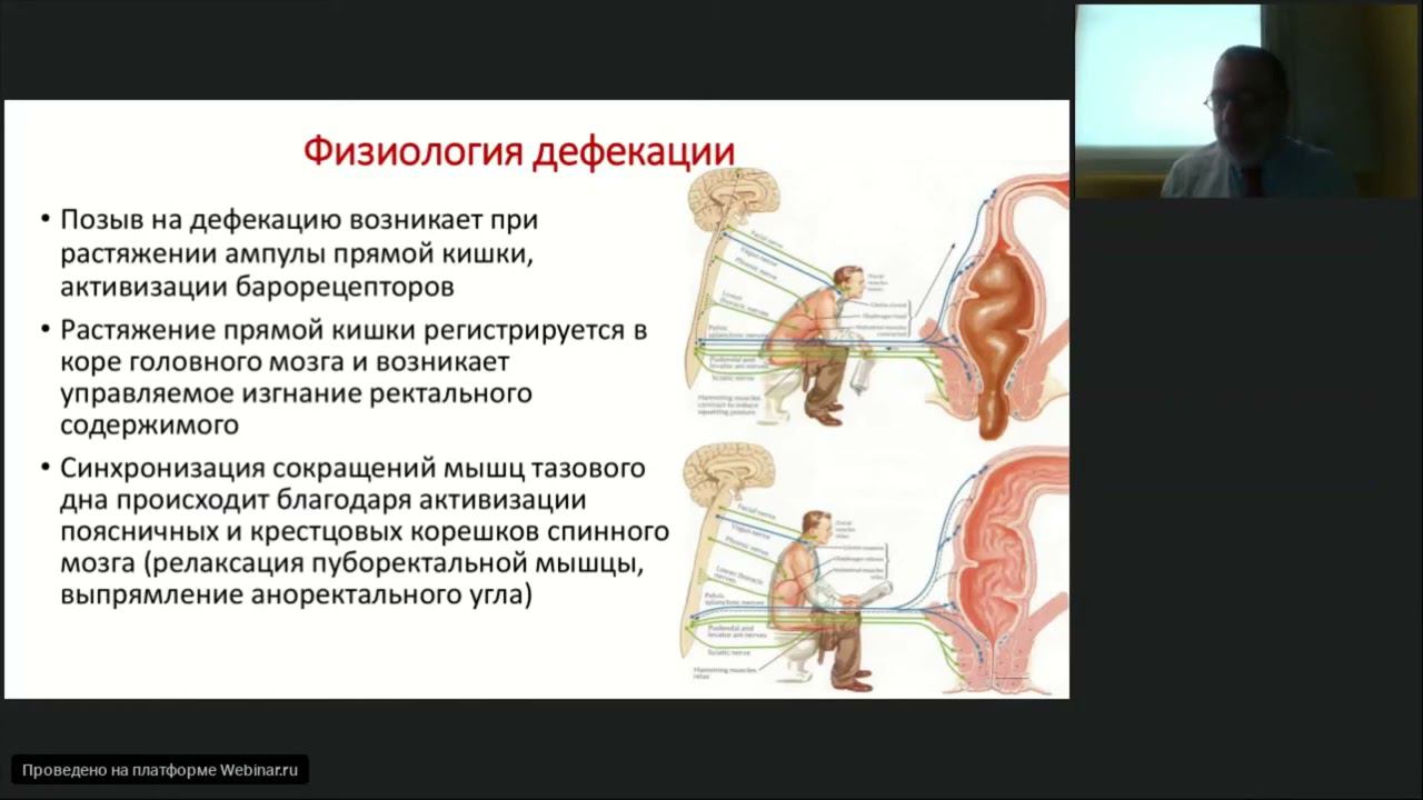 "Вельтищевские пятницы" Функциональные запоры у детей. Гл. науч. сотр., д.м.н. Хавкин А.И.