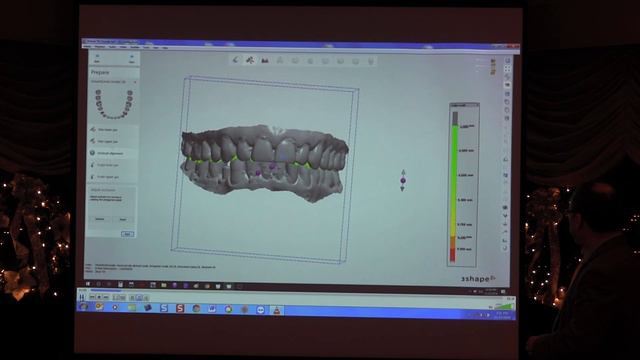 Shuaib Raza MDT A-Dent Restorations Dental Lab смотреть онлайн