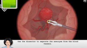 Operate Now : Brain Surgery Gameplay