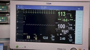 Хирургия рака легкого в запущенной стадии: можно ли сохранить долю легкого ?