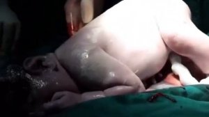 Girl giving birth a cute baby