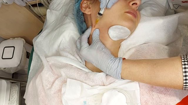 29.01 Векторный лифтинг. Шея(фрагмент). смотреть онлайн