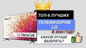 ТОП—6. 📺Лучшие телевизоры LG. 🔥Рейтинг 2024. Какой LG телевизор и размер лучше выбрать для покупки