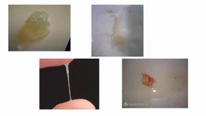 Как отходит пробка