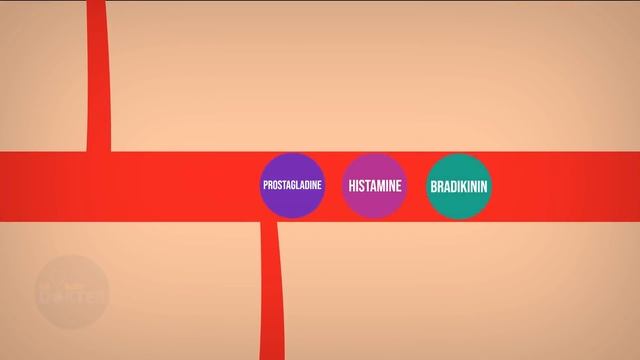 Keseleo? Jangan Asal Dipijat!! смотреть онлайн