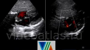 Сравнение ДМПП и ООО