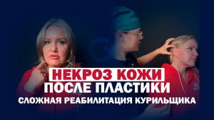 Фейслифтинг, липосакция нижней трети лица и платизмопластика для курильщицы